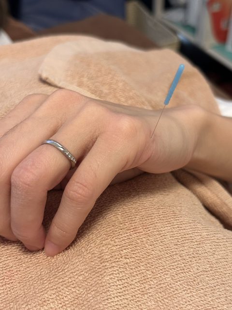 鍼治療のツボ①後渓