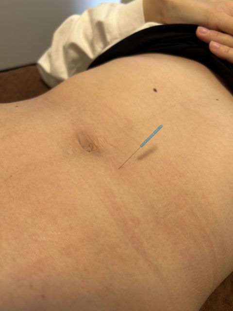 鍼治療のツボ④天枢(てんすう)